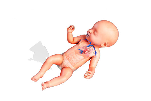 علت نقص مادرزادی قلب در نوزادان