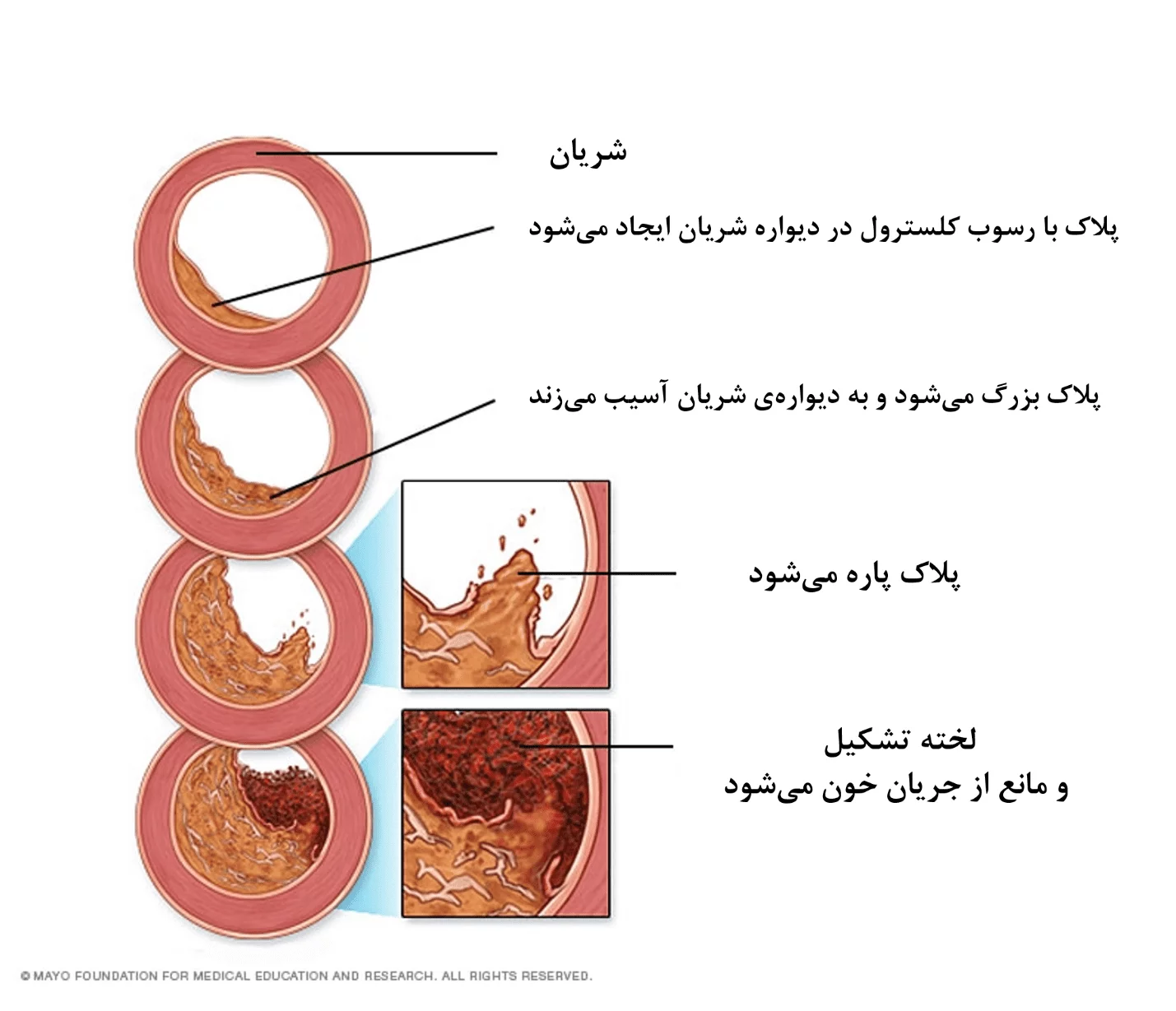 آیا کلسترول بالا خطرناک است؟